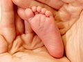 Профилактика плоскостопия у детей