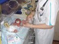 Что такое гипоксия плода